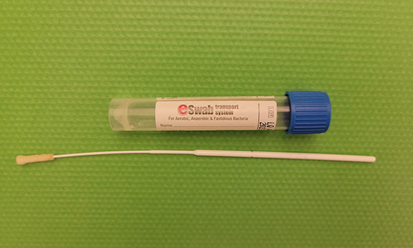 laboratory tube with a blue cap and matching swab